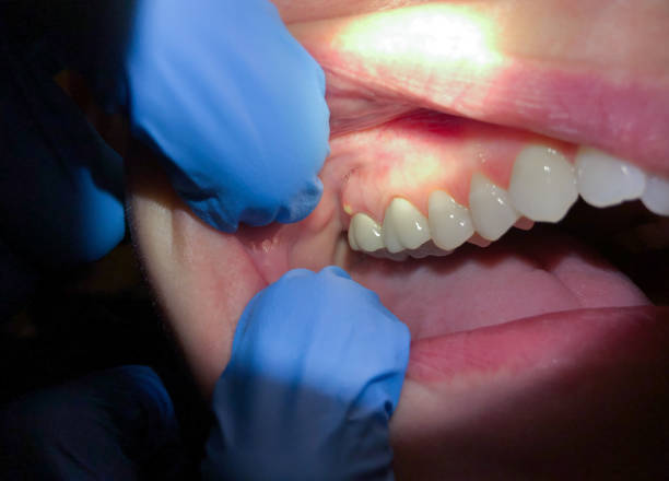 Best Walk-In Emergency Dental Services in Genola, UT